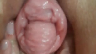 Loose pumped pussy prolapse pushing out